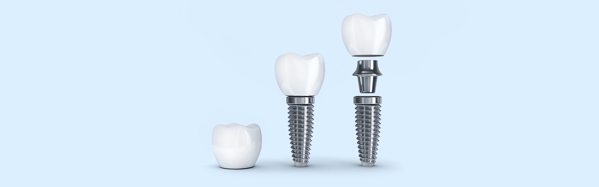 Teeth Replacement Options Whether Single or Multiple Not Challenging to Find